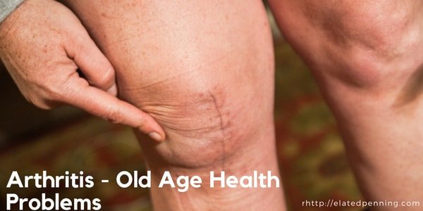 Arthritis old age health problems